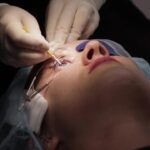 A Detailed Guide to Choose Between LASIK, SMILE, and PRK